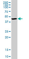 Western blot - Anti-BDH1 antibody (AB103500)
