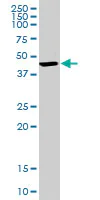 Western blot - Anti-BDH1 antibody (AB103500)