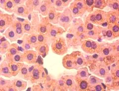 Immunohistochemistry (Formalin/PFA-fixed paraffin-embedded sections) - Anti-BDH1 antibody (AB193156)