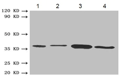 Western blot - Anti-BDH1 antibody (AB193156)