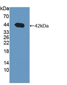 Western blot - Anti-BDH1 antibody (AB231940)