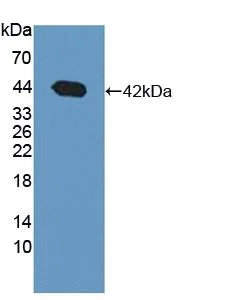 Western blot - Anti-BDH1 antibody (AB231940)