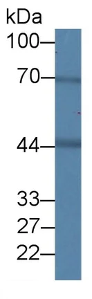 Western blot - Anti-BDH1 antibody (AB231940)
