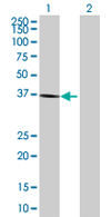 Western blot - Anti-BDH1 antibody (AB68321)