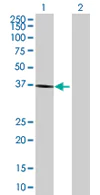 Western blot - Anti-BDH1 antibody (AB68321)