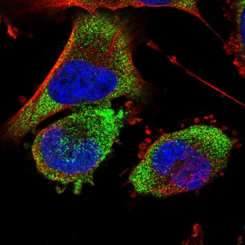 Immunocytochemistry/ Immunofluorescence - Anti-BDH2 antibody (AB254710)