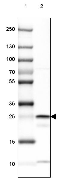 Western blot - Anti-BDH2 antibody (AB254710)