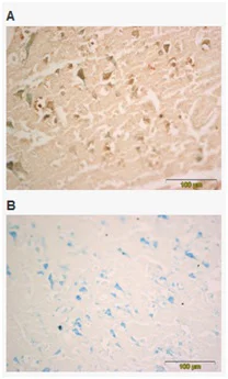 Immunohistochemistry (Formalin/PFA-fixed paraffin-embedded sections) - Anti-BDNF antibody [3B2] (AB205067)