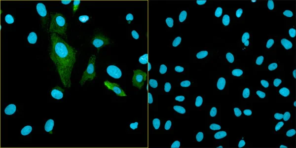 Immunocytochemistry/ Immunofluorescence - Anti-BDNF antibody [3C11] (AB203573)