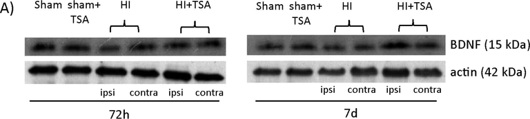 Western blot - Anti-BDNF antibody [3C11] (AB203573)