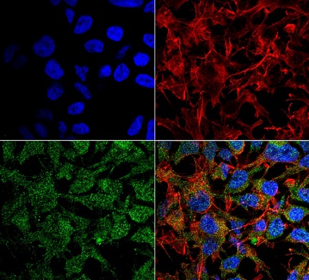 Immunocytochemistry/ Immunofluorescence - Anti-BDNF antibody (AB223354)