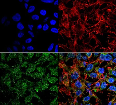 Immunocytochemistry/ Immunofluorescence - Anti-BDNF antibody (AB223354)