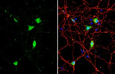 Immunocytochemistry/ Immunofluorescence - Anti-BDNF antibody (AB226843)