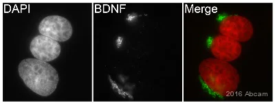 Immunocytochemistry/ Immunofluorescence - Anti-BDNF antibody [EPR1292] - Low endotoxin, Azide free (AB216443)