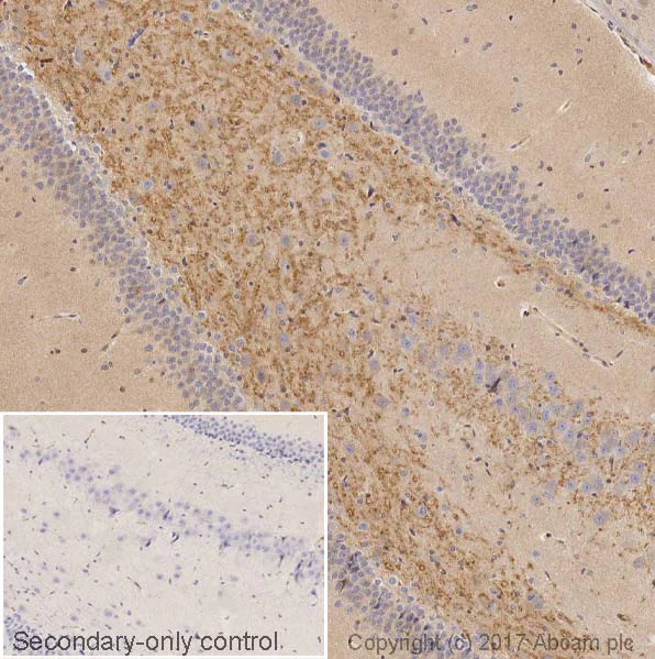 Immunohistochemistry (Formalin/PFA-fixed paraffin-embedded sections) - Anti-BDNF antibody [EPR21211] (AB213323)