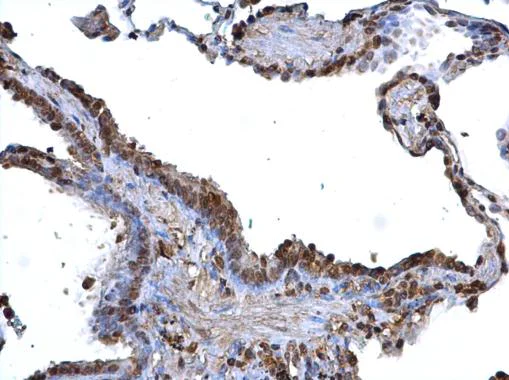 Immunohistochemistry (Formalin/PFA-fixed paraffin-embedded sections) - Anti-BDP / ARID3B antibody (AB227870)