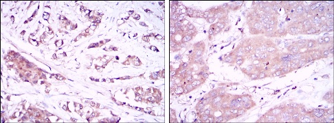 Immunohistochemistry (Formalin/PFA-fixed paraffin-embedded sections) - Anti-Beclin 1 antibody [2A4] (AB114071)