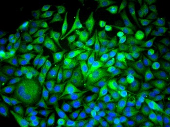 Immunocytochemistry/ Immunofluorescence - Anti-Beclin 1 antibody (AB217179), expandable thumbnail