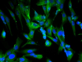 Immunocytochemistry/ Immunofluorescence - Anti-Beclin 1 antibody (AB217179), expandable thumbnail