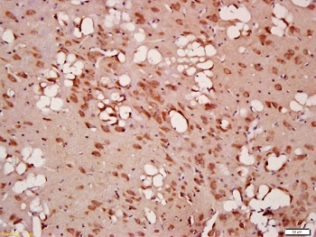 Immunohistochemistry (Formalin/PFA-fixed paraffin-embedded sections) - Anti-Beclin 1 antibody (ab217179), expandable thumbnail