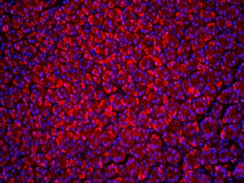 Immunohistochemistry (Formalin/PFA-fixed paraffin-embedded sections) - Anti-Beclin 1 antibody (AB217179), expandable thumbnail