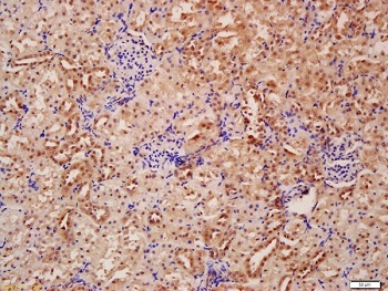 Immunohistochemistry (Formalin/PFA-fixed paraffin-embedded sections) - Anti-Beclin 1 antibody (ab217179), expandable thumbnail