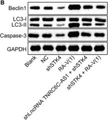 Western blot - Anti-Beclin 1 antibody (ab217179), expandable thumbnail
