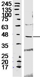 Western blot - Anti-Beclin 1 antibody (AB217179), expandable thumbnail