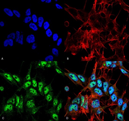 Immunocytochemistry/ Immunofluorescence - Anti-Beclin 1 antibody (AB223348)