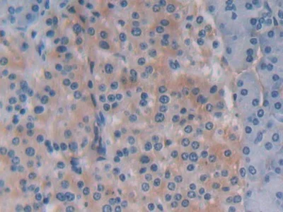 Immunohistochemistry (Formalin/PFA-fixed paraffin-embedded sections) - Anti-Beclin 1 antibody (AB231341)