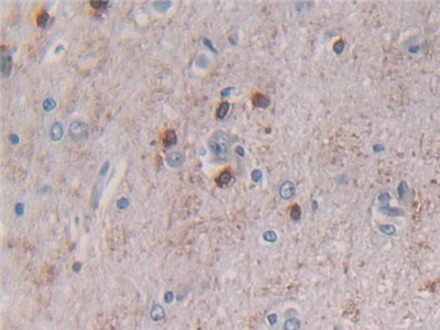 Immunohistochemistry (Formalin/PFA-fixed paraffin-embedded sections) - Anti-Beclin 1 antibody (AB231341)