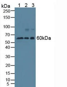 Western blot - Anti-Beclin 1 antibody (AB231341)