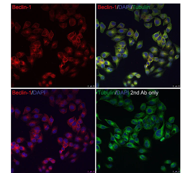 Immunocytochemistry/ Immunofluorescence - Anti-Beclin 1 antibody (AB62557)