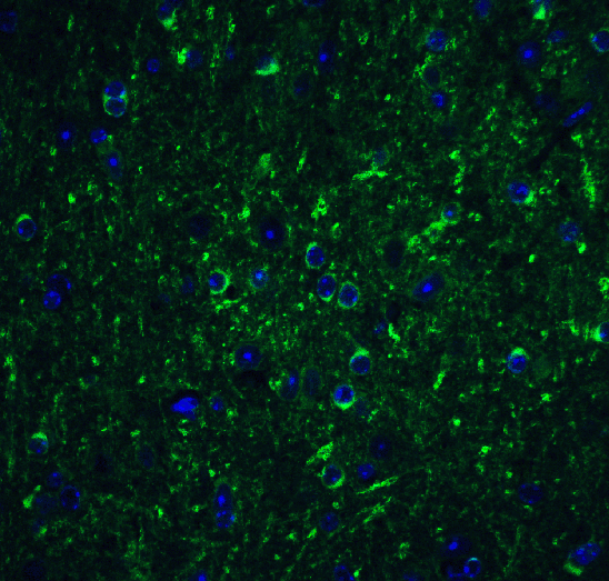 Immunofluorescence - Anti-Beclin 1 antibody (AB62557), expandable thumbnail