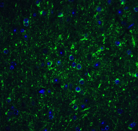 Immunofluorescence - Anti-Beclin 1 antibody (AB62557)