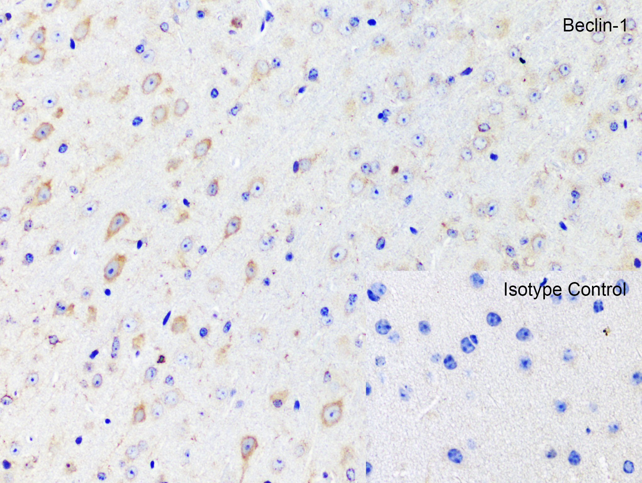 Immunohistochemistry (Formalin/PFA-fixed paraffin-embedded sections) - Anti-Beclin 1 antibody (ab62557), expandable thumbnail