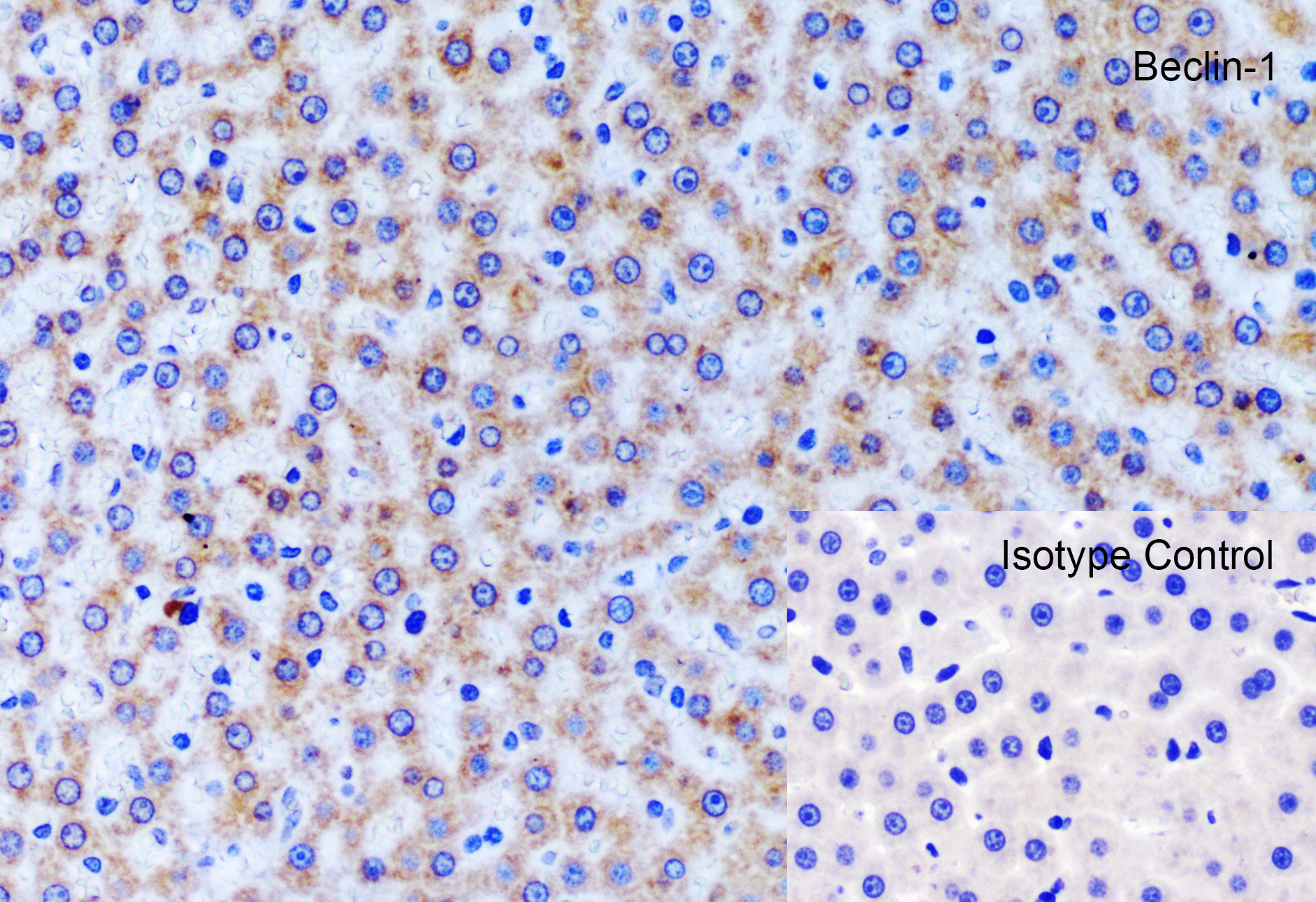 Immunohistochemistry (Formalin/PFA-fixed paraffin-embedded sections) - Anti-Beclin 1 antibody (ab62557), expandable thumbnail
