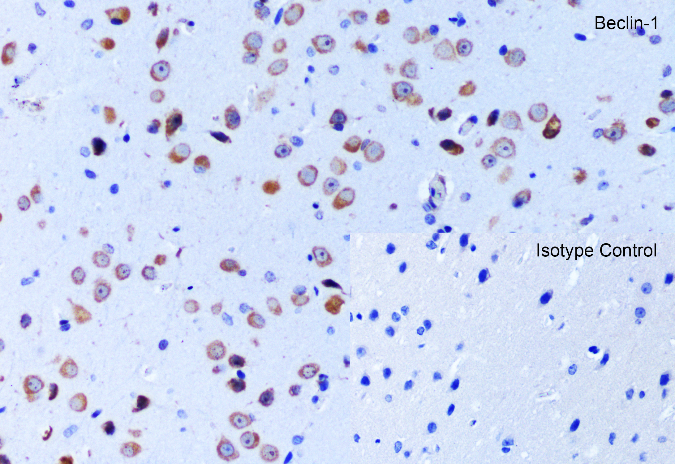 Immunohistochemistry (Formalin/PFA-fixed paraffin-embedded sections) - Anti-Beclin 1 antibody (ab62557), expandable thumbnail