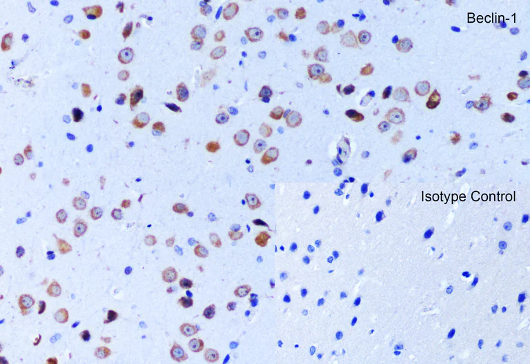 Immunohistochemistry (Formalin/PFA-fixed paraffin-embedded sections) - Anti-Beclin 1 antibody (AB62557)