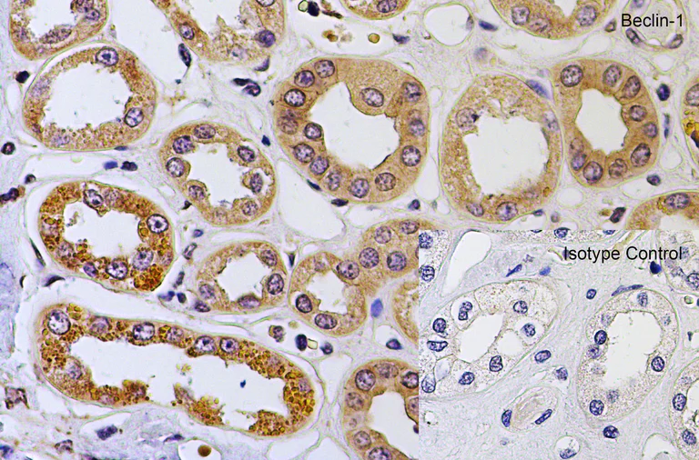 Immunohistochemistry (Formalin/PFA-fixed paraffin-embedded sections) - Anti-Beclin 1 antibody (AB62557)