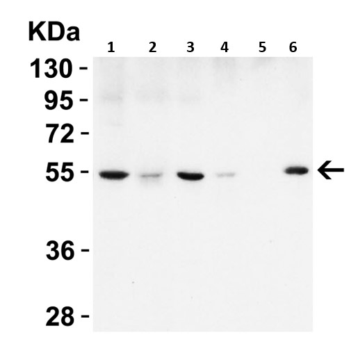 Western blot - Anti-Beclin 1 antibody (AB62557), expandable thumbnail