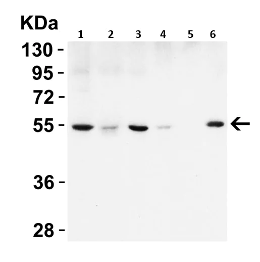 Western blot - Anti-Beclin 1 antibody (AB62557)