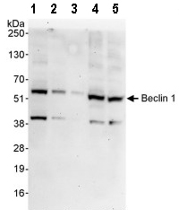 Western blot - Anti-Beclin 1 antibody (AB92389), expandable thumbnail