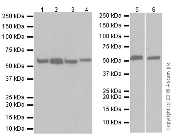 Western blot - Anti-Beclin 1 antibody [EPR19662] (AB207612)