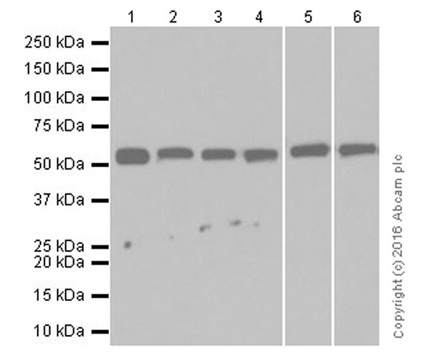 Western blot - Anti-Beclin 1 antibody [EPR19662] (AB207612), expandable thumbnail