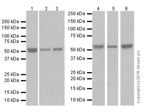 Western blot - Anti-Beclin 1 antibody [EPR19662] (AB207612)