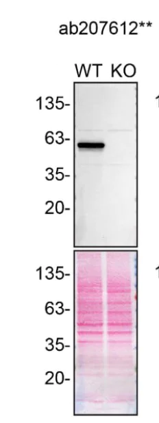 Western blot - Anti-Beclin 1 antibody [EPR19662] (AB207612)