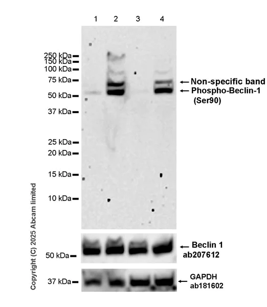 Western blot - Anti-Beclin 1 antibody [EPR19662] (AB207612)
