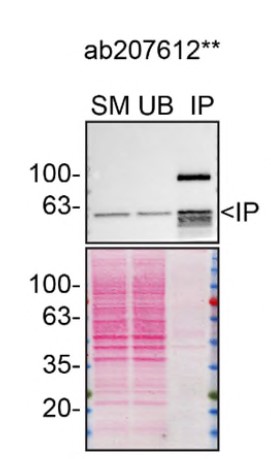 Immunoprecipitation - Anti-Beclin 1 antibody [EPR19662] - BSA and Azide free (AB227107)