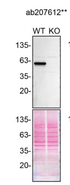 Western blot - Anti-Beclin 1 antibody [EPR19662] - BSA and Azide free (AB227107)